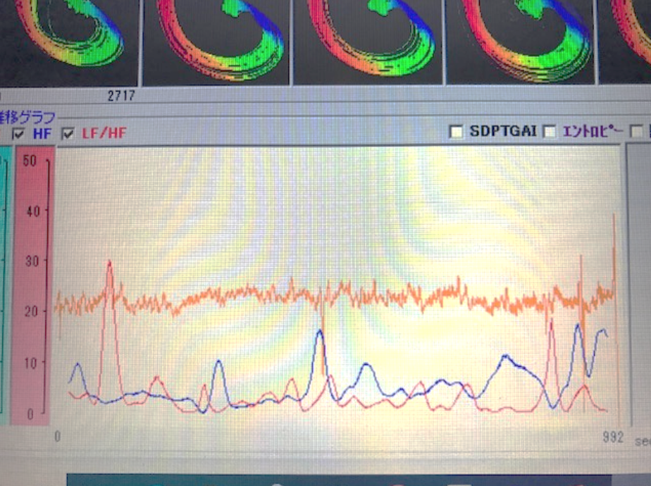 解析画面の一部